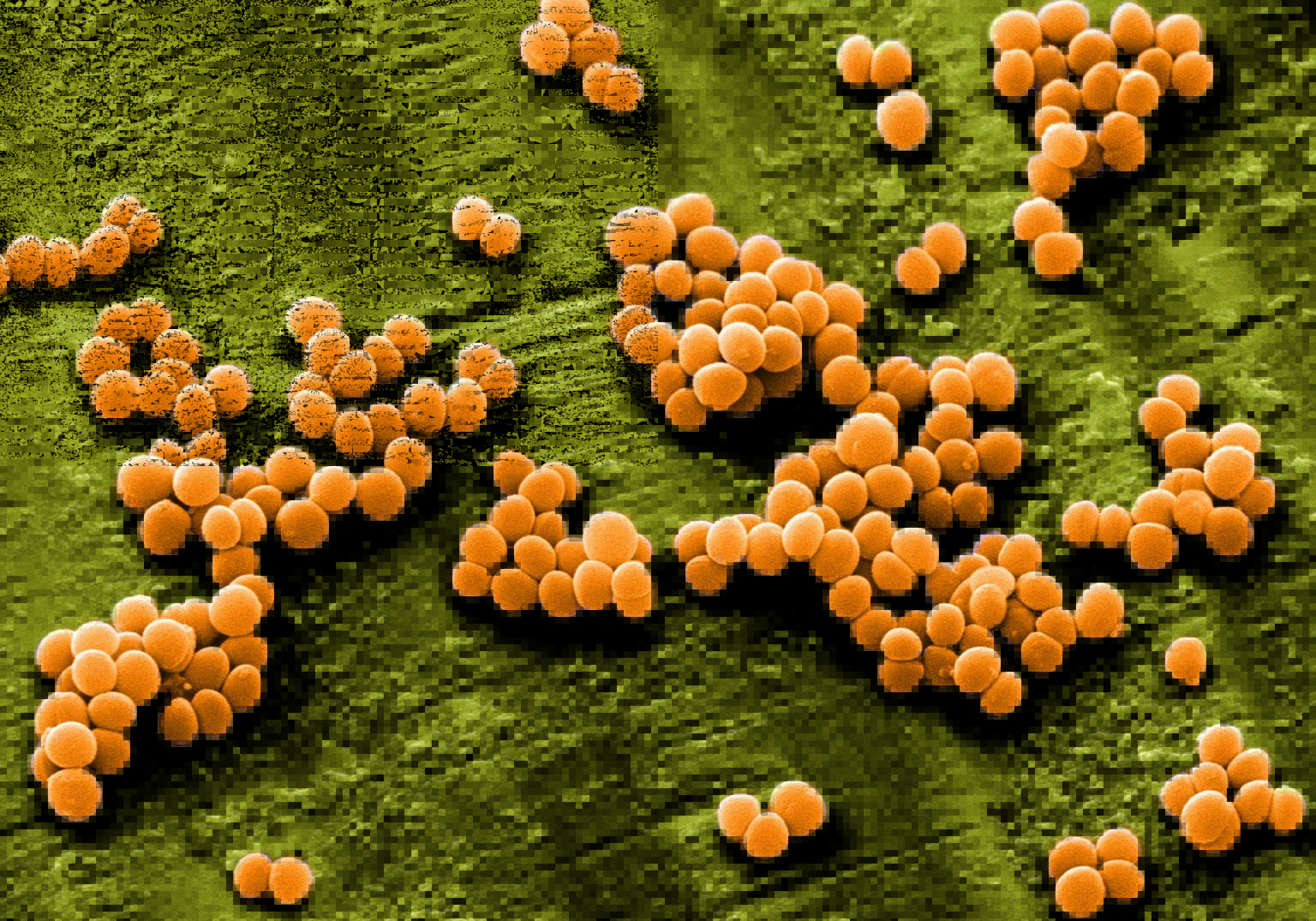 Staphylococcus aureus 3. Сапрофитный стафилококк. Сапрофитные кокки. Сапрофитный стафилококк под микроскопом. Бактерии стафилококки.